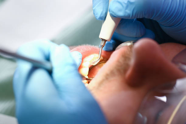 Best Emergency Denture Repair in Clayton, CA