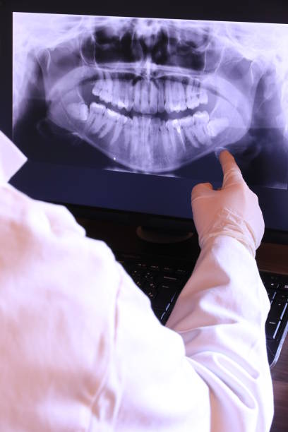 Best Broken or Chipped Tooth Repair in Clayton, CA