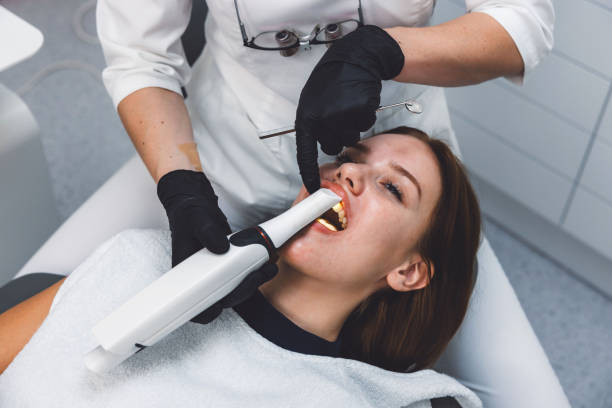 Best Knocked-Out Tooth (Avulsed Tooth) Treatment in Clayton, CA